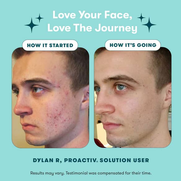Proactiv® Solution 3-Step System | 90 Day Acne Treatment Kit