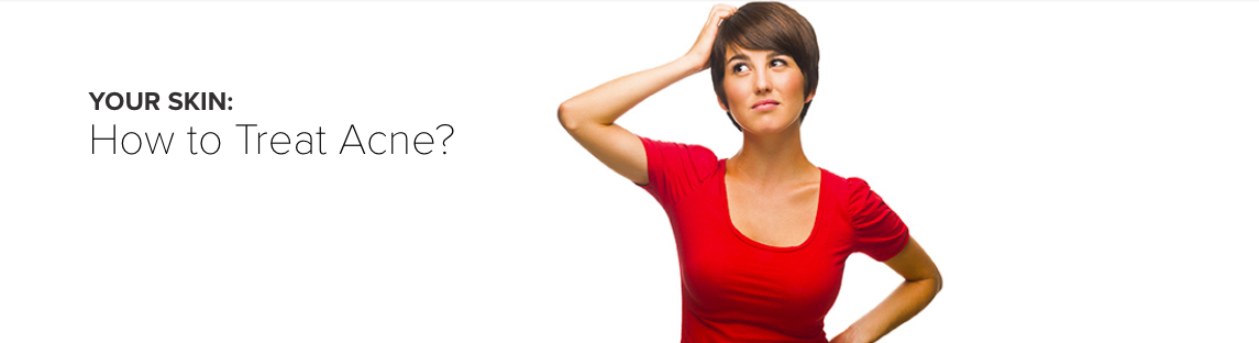 How to Treat Acne?