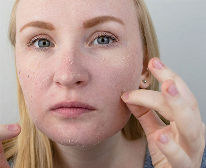 How to get rid of dead skin cells on your face