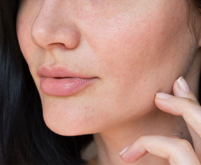 The top four myths about your pores – debunked