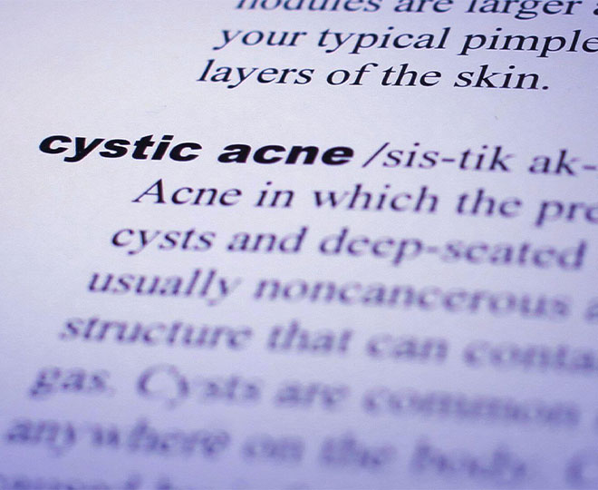 Nodular Acne and Cystic Acne