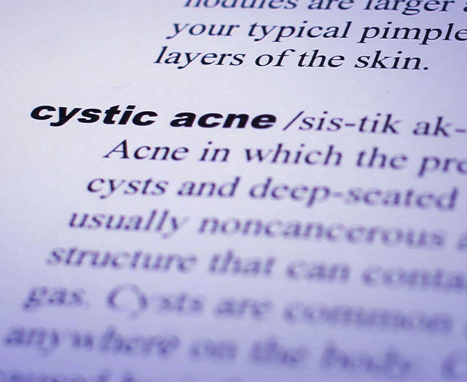 nodular acne vs cystic acne