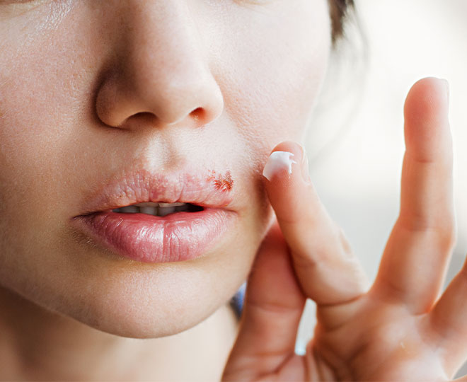 How to get rid of pimple scabs