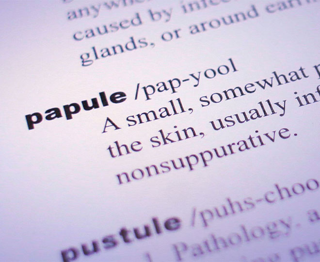 Papules and Pustules, How to Get Rid of Acne