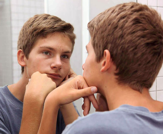 How to get rid of teenage acne