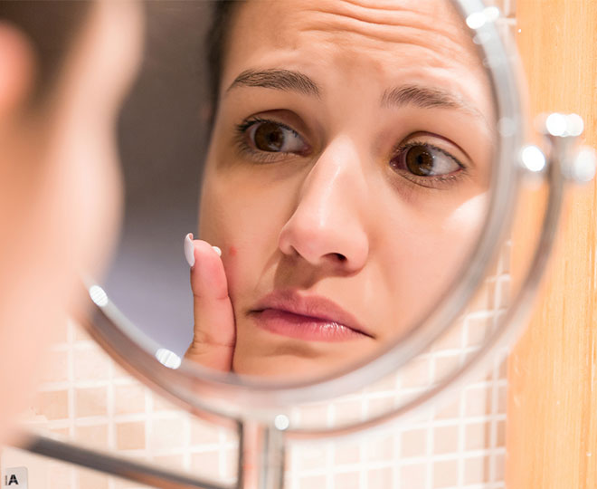 How to stop getting acne in the same spot