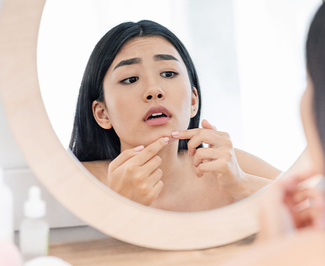 Is popping a pimple bad? | Proactiv®