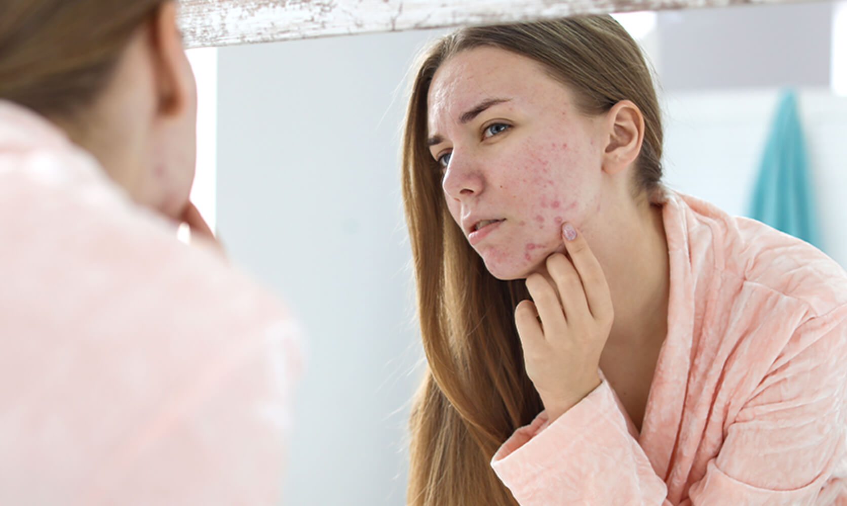 How to clear and prevent clogged pores | Proactiv®