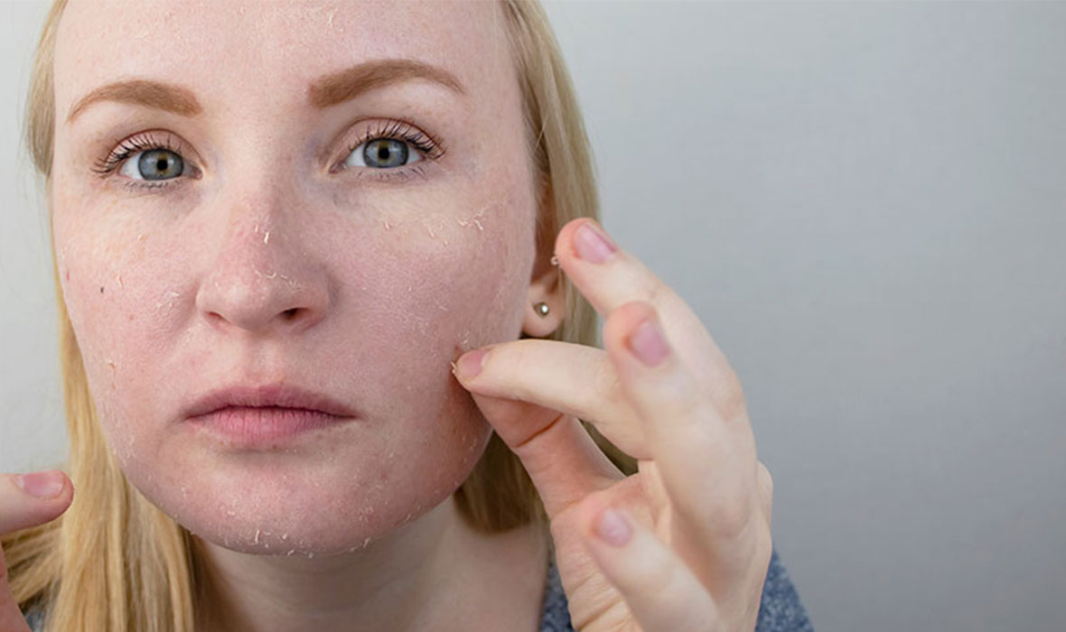 How to remove dead skin cells from your face & why it’s important