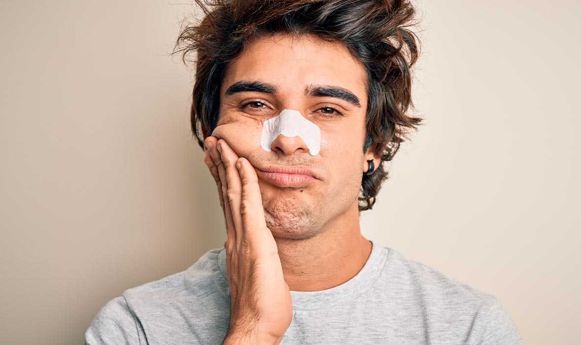 What causes blackheads?